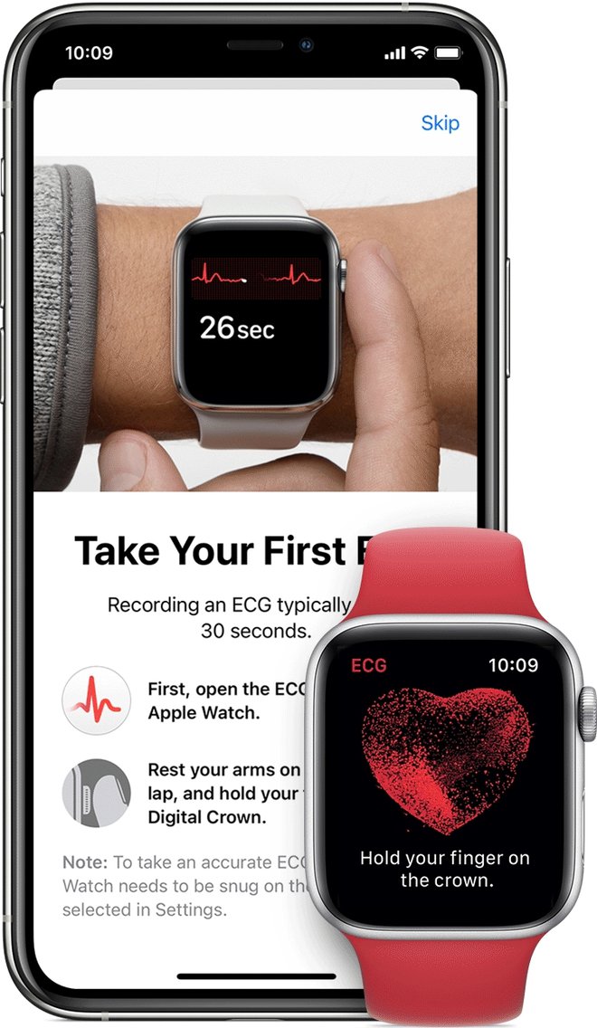 Applove pametne ure že več kot dve leti omogočajo EKG. A ne pri nas.
