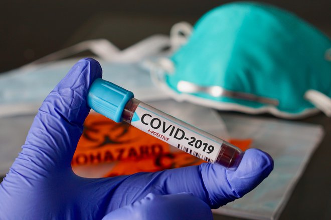 Znanstvenika sta med analiziranjem vzorcev covid-19 odkrila prstne odtise, ki naj bi dokazovali umetni nastanke virusa. Foto: Samara Heisz/Getty Images/iStockphoto