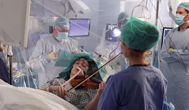Violinistka Dagmar Turner je z igranjem na svoj instrument pomagala kirurgom, da med operacijo odstranitve tumorja niso poškodovali njenih možganov. Nov in inovativen pristop naj bi zagotovil, da med natančnim posegom ne bodo prizadeta področja možganov, ki so odgovorna za občutljivo gibanje rok, 19. februar 2020, Kings College Hospital, London, Velika Britanija. Foto: AFP photo / Kings College Hospital
