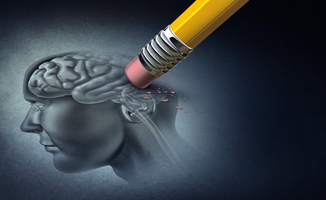 Bi lahko možganska stimulacija upočasnila neizogibno napredovanje Alzheimerjeve bolezni in odpravila nekatere njene simptome? Foto: Shutterstock
